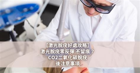 脫墨面相|【激光脫癦】CO2激光脫墨脫痣原理+注意事項